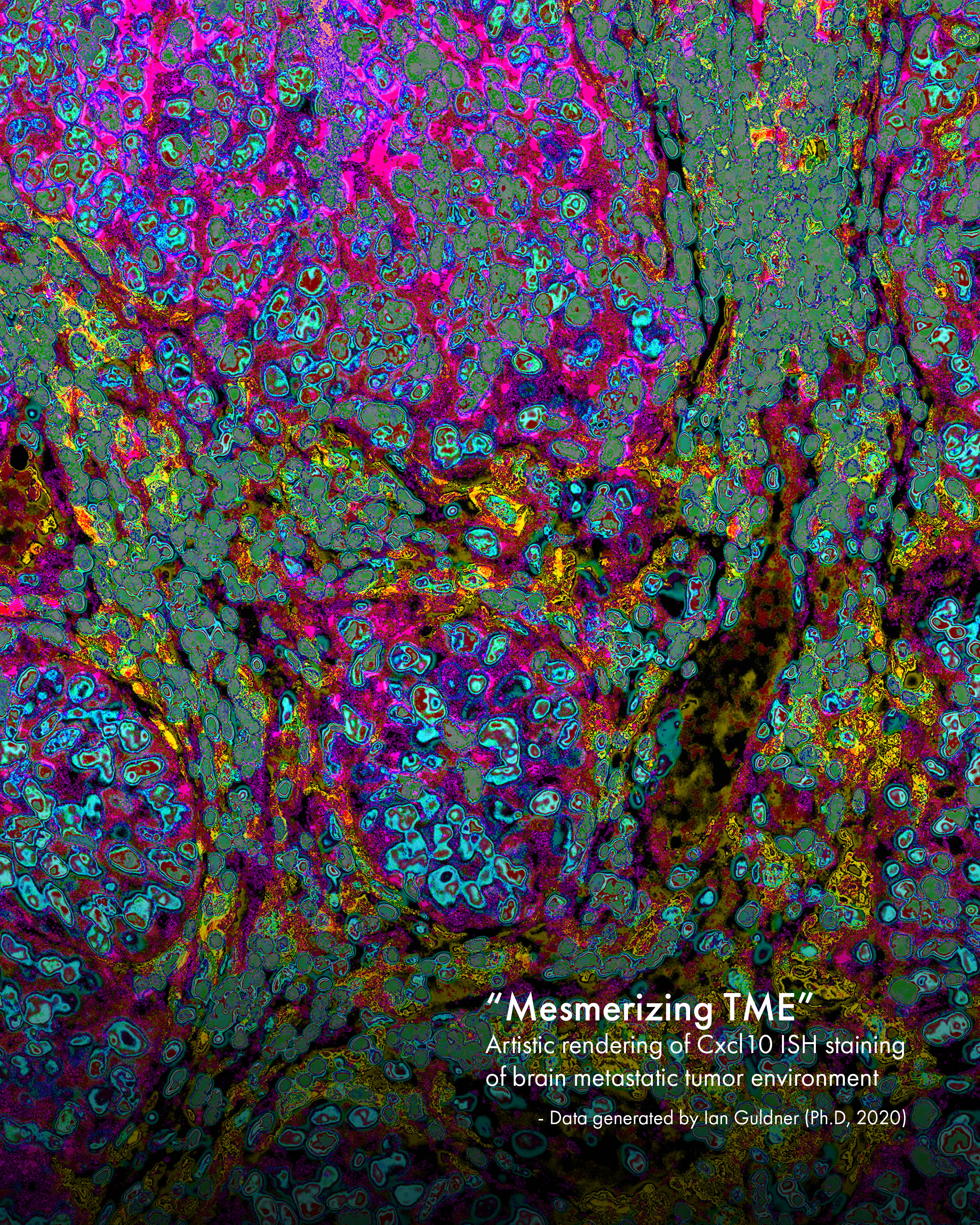 Mesmerizing TME